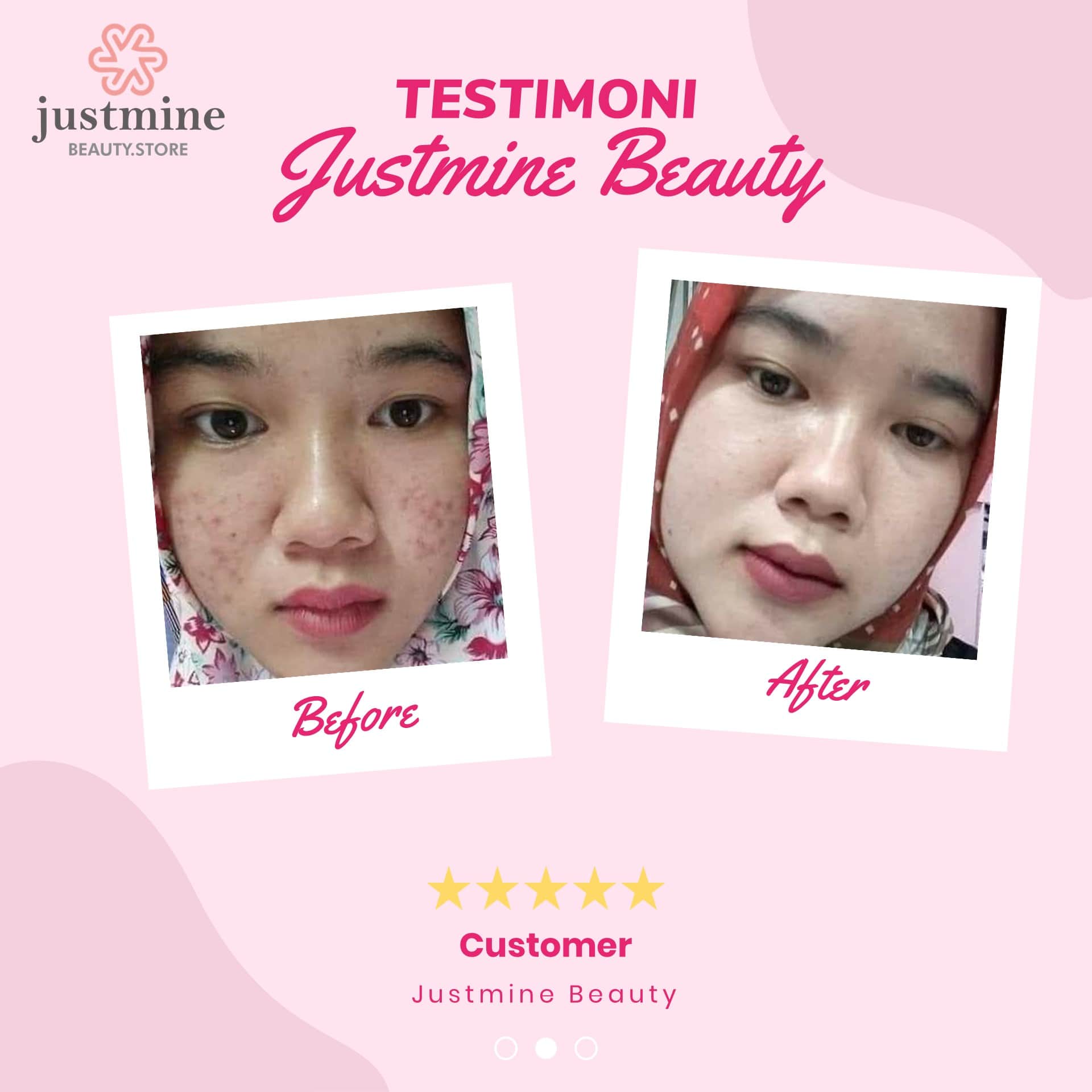 testimoni-justmine-beauty-21102020b-min.jpg