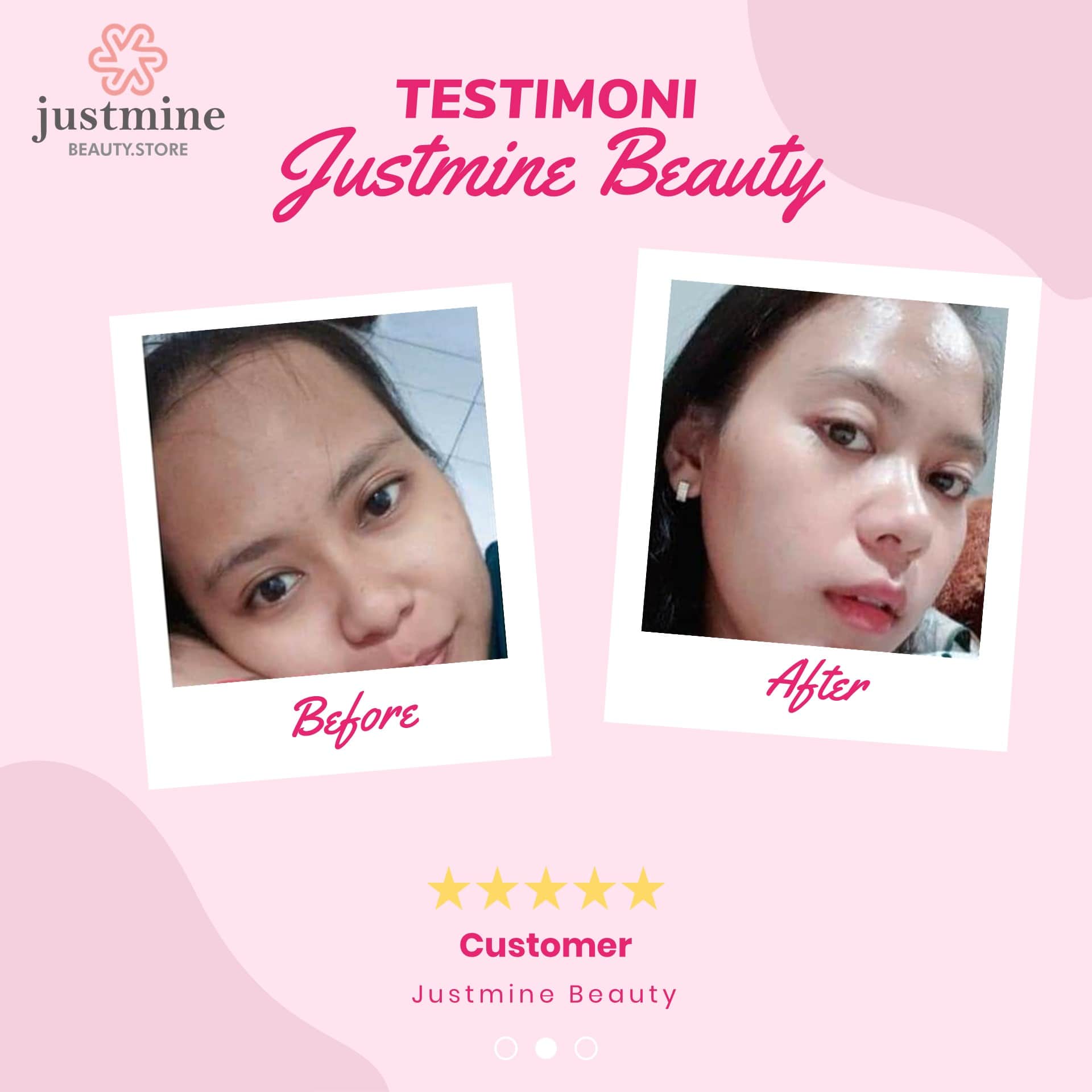 testimoni-justmine-beauty-21102020e-min.jpg