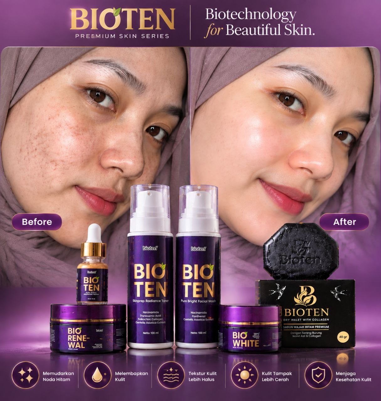bioten -10-03_08-09-31